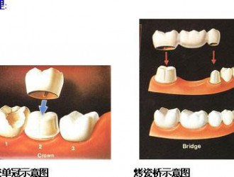 口腔治療中的騙局都有哪些？這些坑不要踩！