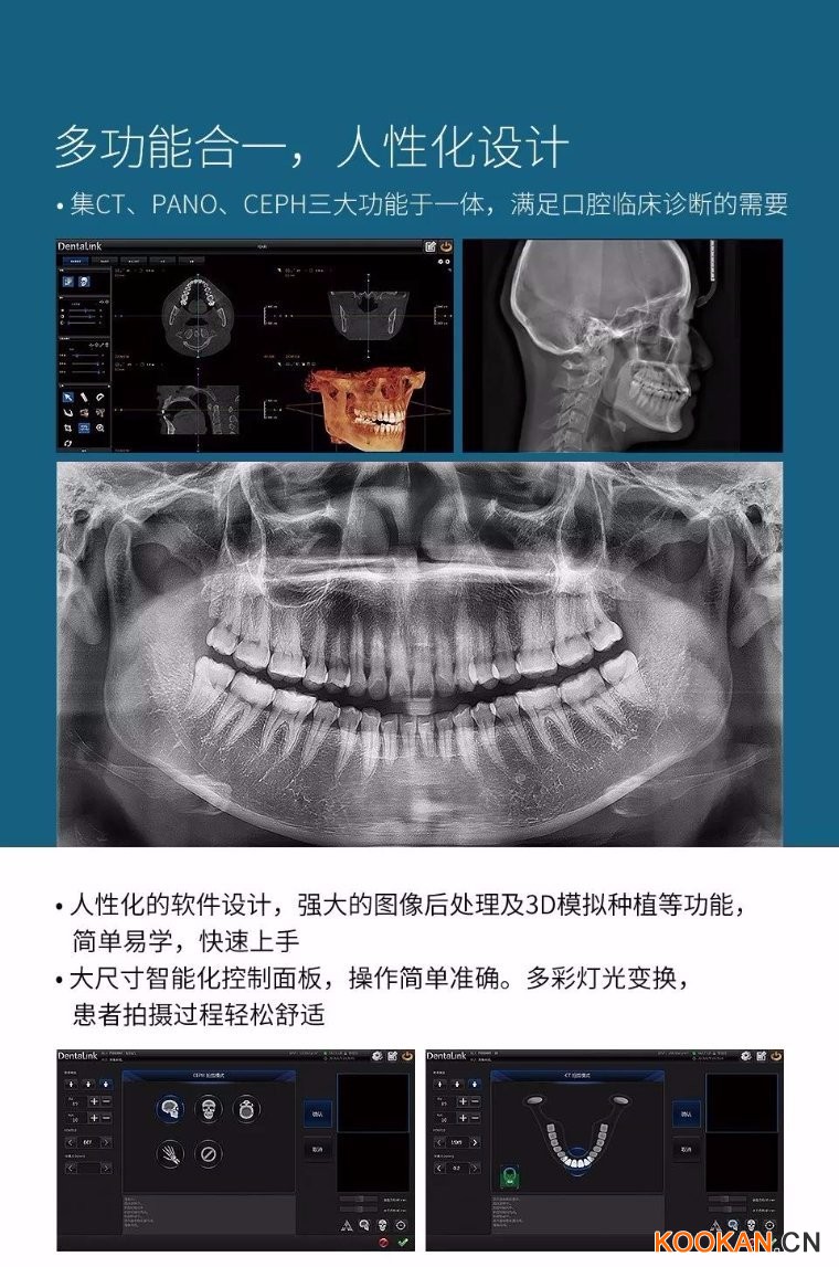 菲森CBCT多功能合一，人性化設(shè)計(jì)