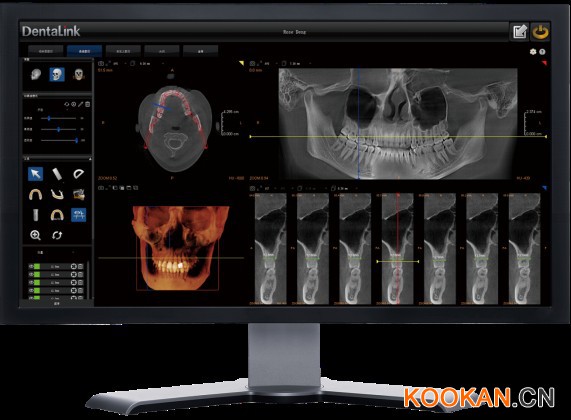 菲森CBCT專業(yè)影像診斷軟件