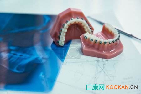 口腔行業(yè)開啟千億級市場，正畸醫(yī)生緊缺