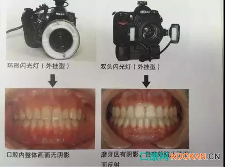 拍不好口腔照片怎么辦？這些口腔攝影方法與技巧請(qǐng)收好！