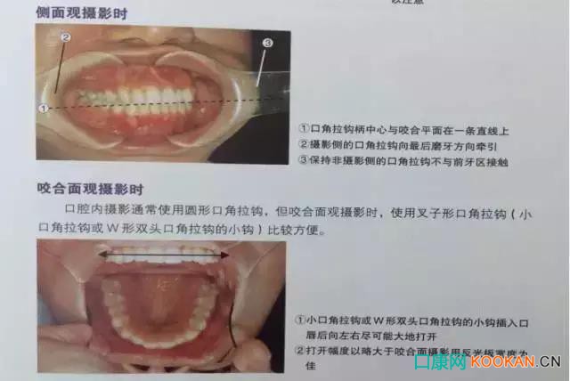 拍不好口腔照片怎么辦？這些口腔攝影方法與技巧請(qǐng)收好！