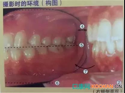 拍不好口腔照片怎么辦？這些口腔攝影方法與技巧請(qǐng)收好！