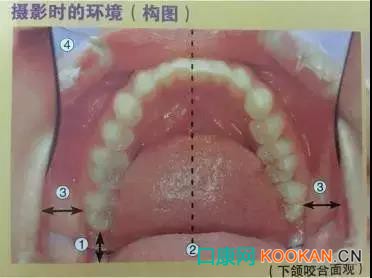 拍不好口腔照片怎么辦？這些口腔攝影方法與技巧請(qǐng)收好！