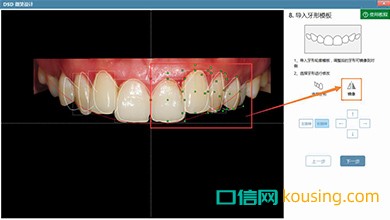 DSD美學(xué)設(shè)計口腔管理軟件鏡像工具實現(xiàn)高效化調(diào)整