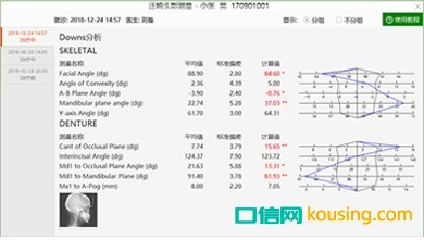 重疊分析